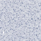 Immunohistochemical staining of human liver shows very weak nuclear positivity in hepatocytes.