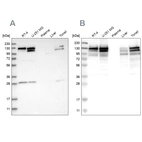 Western blot analysis using Anti-CCAR2 antibody HPA019943 (A) shows similar pattern to independent antibody HPA019907 (B).