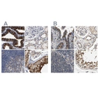 Immunohistochemical staining of human fallopian tube, kidney, lymph node and testis using Anti-RUVBL1 antibody HPA019947 (A) shows similar protein distribution across tissues to independent antibody HPA019948 (B).