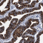 Anti-RUVBL1 Antibody