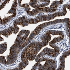 Immunohistochemical staining of human fallopian tube shows high expression.