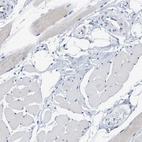 Immunohistochemical staining of human skeletal muscle shows low expression as expected.
