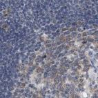 Immunohistochemical staining of human lymph node using Anti-RUVBL1 antibody HPA019947.