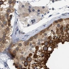 Immunohistochemical staining of human testis using Anti-RUVBL1 antibody HPA019947.