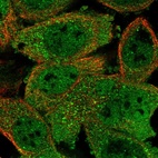 Immunofluorescent staining of human cell line A-431 shows localization to nucleoplasm & cytosol.