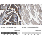Anti-RUVBL1 Antibody