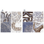 Immunohistochemical staining of human fallopian tube, kidney, lymph node and testis using Anti-RUVBL1 antibody HPA019948 (A) shows similar protein distribution across tissues to independent antibody HPA019947 (B).