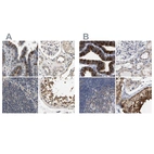 Immunohistochemical staining of human fallopian tube, kidney, lymph node and testis using Anti-RUVBL1 antibody HPA019948 (A) shows similar protein distribution across tissues to independent antibody HPA019947 (B).
