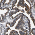 Immunohistochemical staining of human fallopian tube shows high expression.