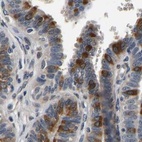 Immunohistochemical staining of human fallopian tube using Anti-RUVBL1 antibody HPA019948.