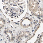 Immunohistochemical staining of human kidney using Anti-RUVBL1 antibody HPA019948.