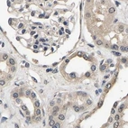 Immunohistochemical staining of human kidney using Anti-RUVBL1 antibody HPA019948.