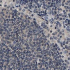 Immunohistochemical staining of human lymph node using Anti-RUVBL1 antibody HPA019948.