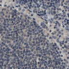Immunohistochemical staining of human lymph node using Anti-RUVBL1 antibody HPA019948.