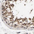 Immunohistochemical staining of human testis using Anti-RUVBL1 antibody HPA019948.