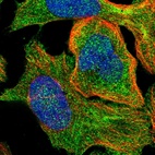 Immunofluorescent staining of human cell line U-2 OS shows localization to plasma membrane, cytosol & actin filaments.