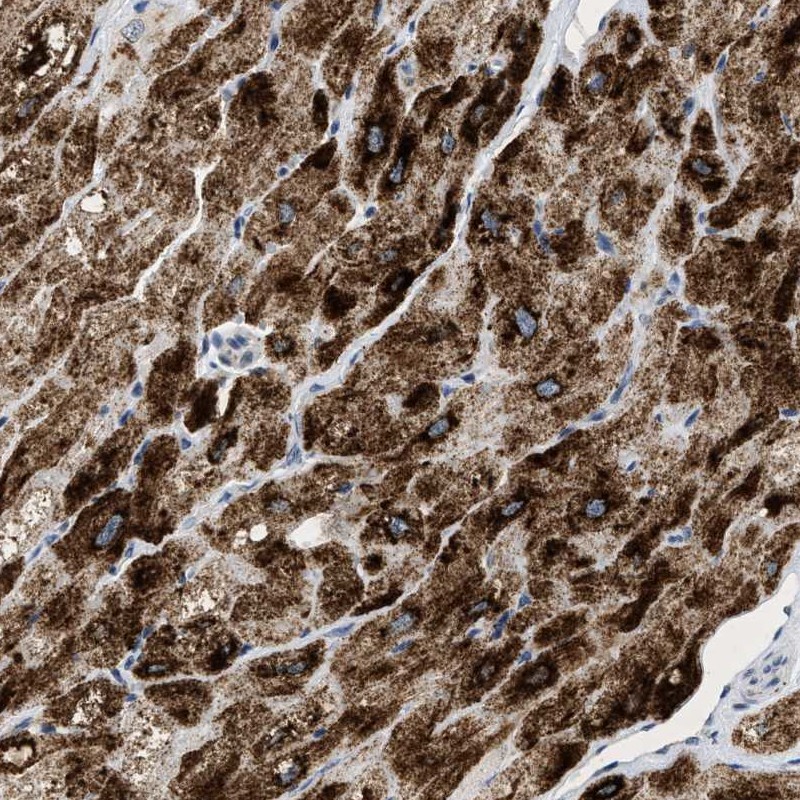 Anti-PPM1L Antibody
