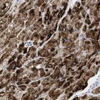 Anti-PPM1L Antibody