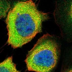 Immunofluorescent staining of human cell line A-431 shows localization to cytosol.