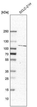 Western blot analysis in human cell line SCLC-21H.
