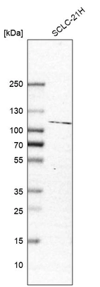 Western blot analysis in human cell line SCLC-21H.