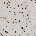 Immunohistochemical staining of human cerebral cortex shows strong nuclear positivity in neurons.