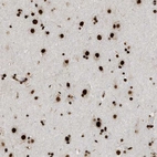 Immunohistochemical staining of human cerebral cortex shows strong nuclear positivity in neurons.