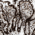 Immunohistochemical staining of human colon shows strong nuclear positivity in glandular cells.
