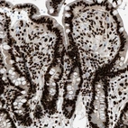 Immunohistochemical staining of human colon shows strong nuclear positivity in glandular cells.