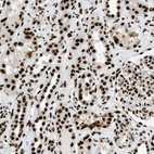 Immunohistochemical staining of human kidney shows strong nuclear positivity in cells in tubules and glomeruli.