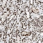 Immunohistochemical staining of human kidney shows strong nuclear positivity in cells in tubules and glomeruli.