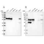 Western blot analysis using Anti-LUC7L3 antibody HPA020017 (A) shows similar pattern to independent antibody HPA018484 (B).