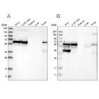 Western blot analysis using Anti-LUC7L3 antibody HPA020017 (A) shows similar pattern to independent antibody HPA018484 (B).