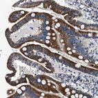 Immunohistochemical staining of human duodenum shows strong cytoplasmic positivity in glandular cells.