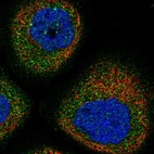 Immunofluorescent staining of human cell line A-431 shows localization to cytosol.