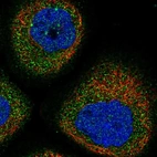 Immunofluorescent staining of human cell line A-431 shows localization to cytosol.