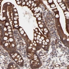 Anti-PDLIM5 Antibody