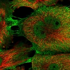 Immunofluorescent staining of human cell line U-251 MG shows localization to nucleoplasm & plasma membrane.