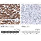 Anti-RYR2 Antibody