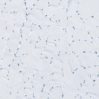Immunohistochemical staining of human skeletal muscle shows no positivity in myocytes as expected.