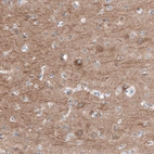 Immunohistochemical staining of human cerebral cortex shows moderate cytoplasmic positivity in neurons.