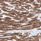 Immunohistochemical staining of human heart muscle shows moderate to strong cytoplasmic positivity in cardiomyocytes.