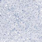 Immunohistochemical staining of human liver shows no positivity in hepatocytes as expected.