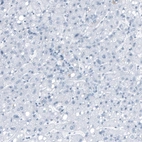 Immunohistochemical staining of human liver shows no positivity in hepatocytes as expected.