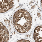Immunohistochemical staining of human testis shows strong cytoplasmic positivity in cells in seminiferous ducts.