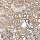 Immunohistochemical staining of human kidney shows weak to moderate cytoplasmic positivity in cells in tubules.