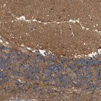 Immunohistochemical staining of human cerebellum shows moderate positivity in neuropil.