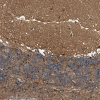 Immunohistochemical staining of human cerebellum shows moderate positivity in neuropil.