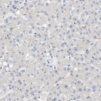 Immunohistochemical staining of human liver shows no positivity in hepatocytes as expected.