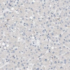Immunohistochemical staining of human liver shows no positivity in hepatocytes as expected.